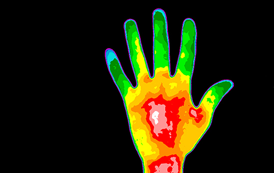 Thermographic image of a person's hand.